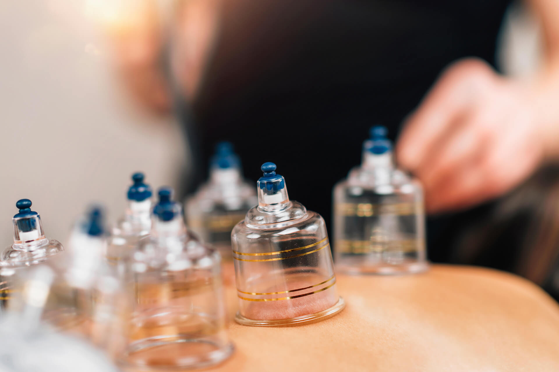 Hijama Zaandam - Dry Cupping