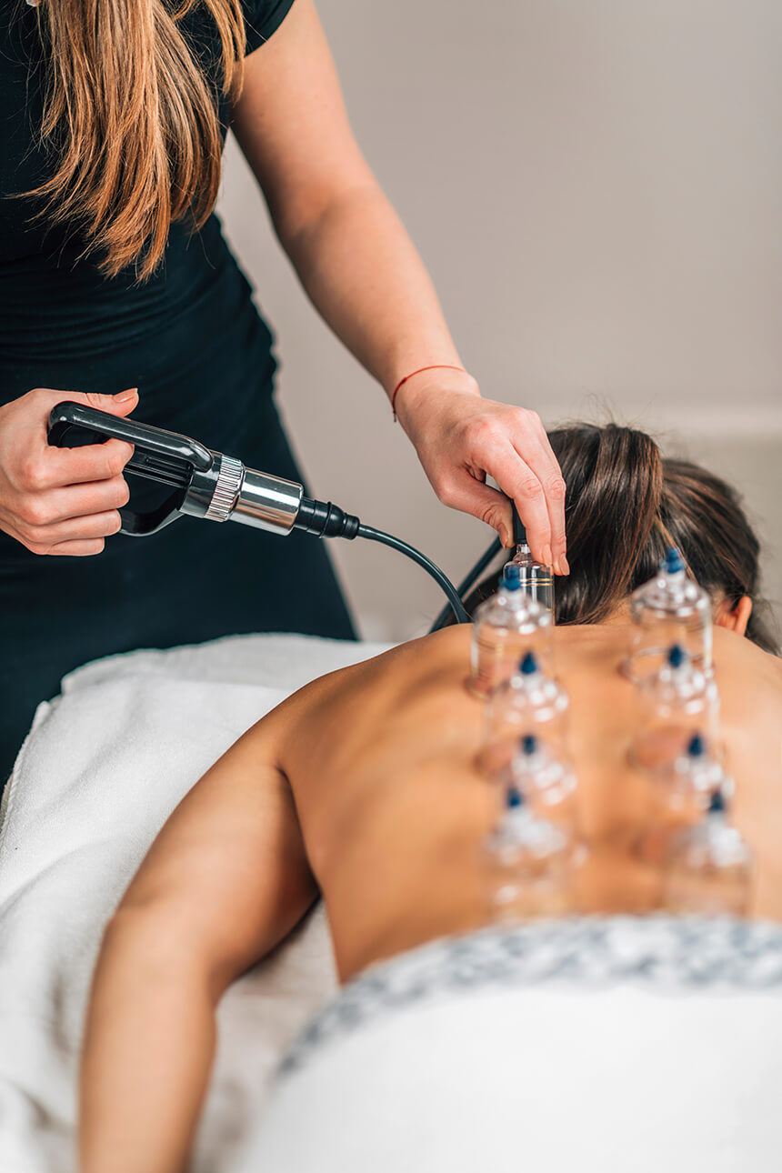 Hijama Zaandam - Wat is Hijama Cupping